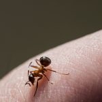 How To Treat Ant Bites